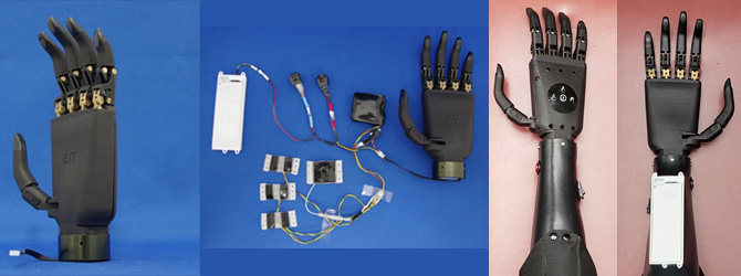 左より、五指駆動型ロボットハンド、五指駆動型筋電義手システム全体、ソケットへの組付け例
